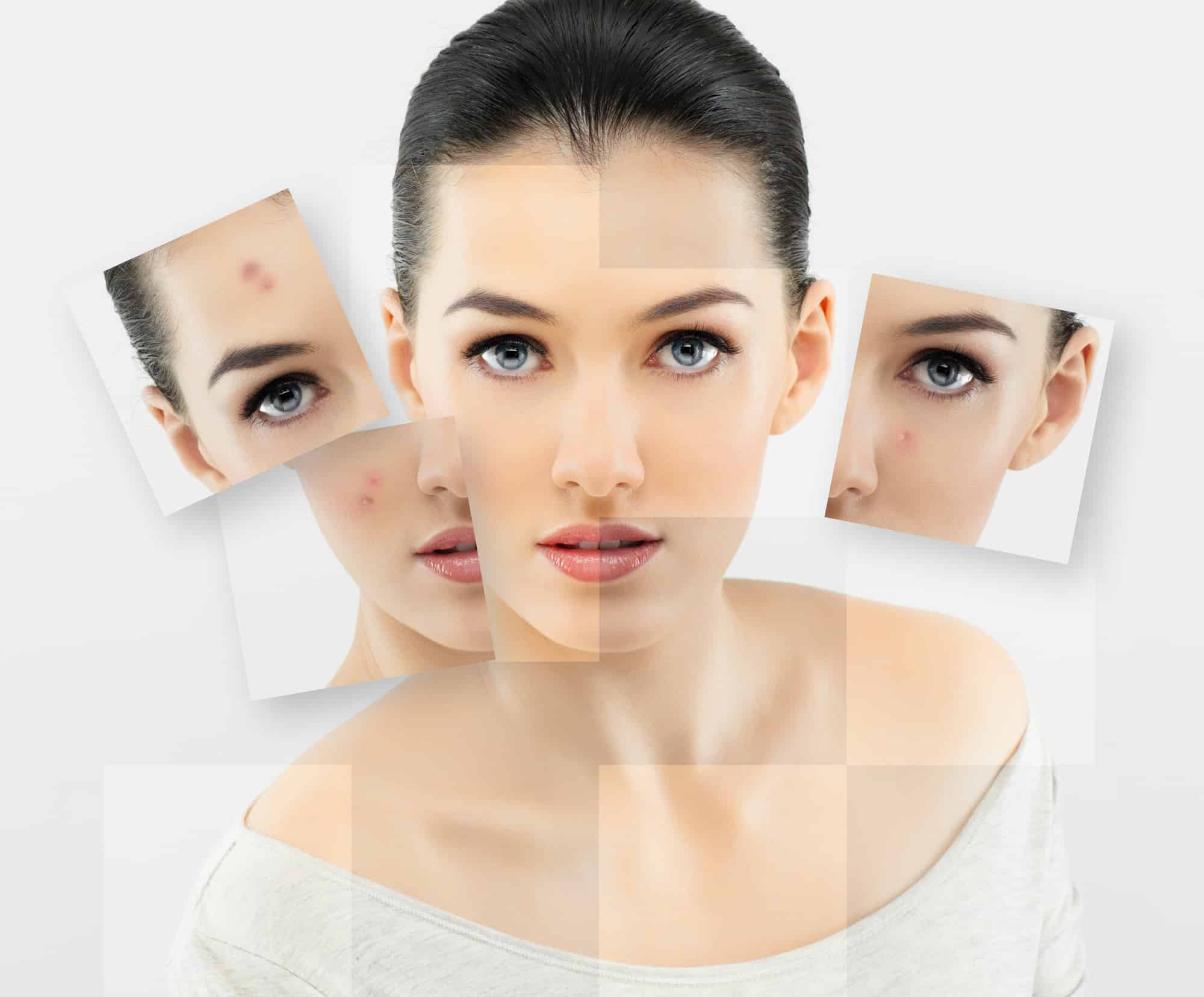 NuSkin Produkte gegen Hautunreinheiten